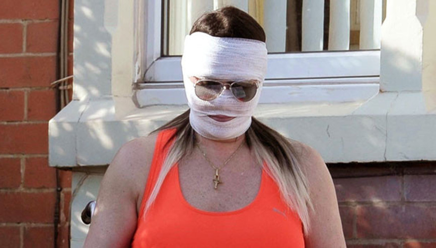 Kaza geçirmedi, güzelleşmek istedi