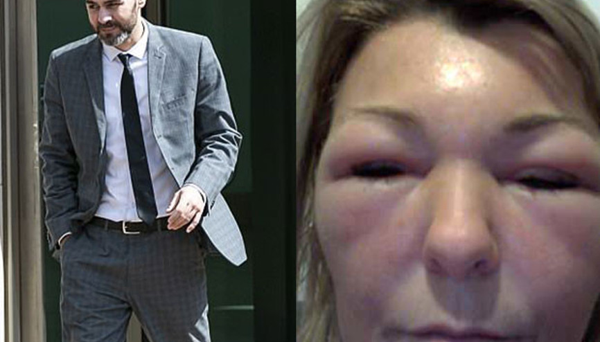 Doktor Ozan İngiltereyi karıştırdı Kadınları bu hale getirdi