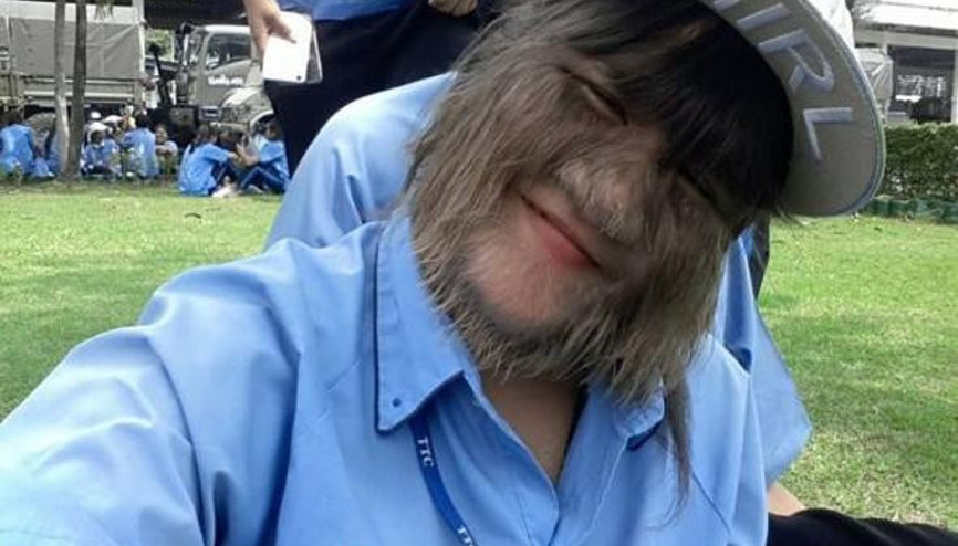 Arkadaşları kurt kız diye çağırıyordu... Artık görenler tanıyamıyor