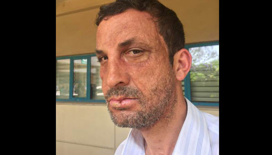 Saçım 25, sakalım 39