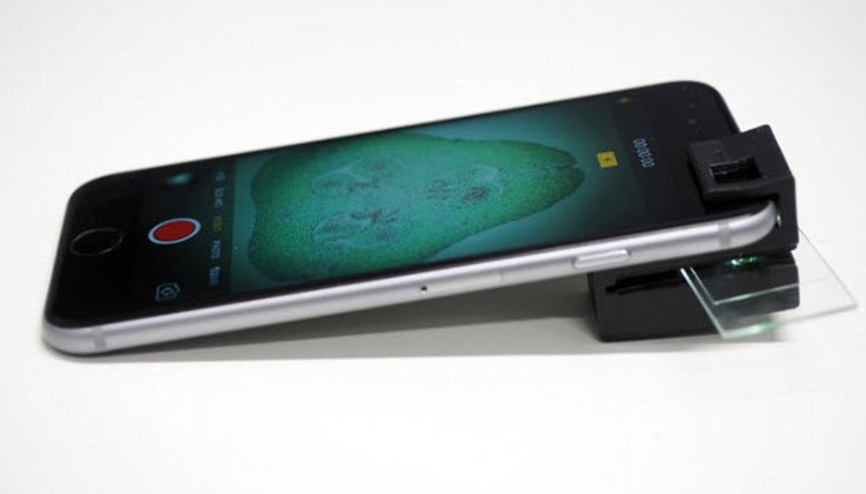 Bilim insanları yaptı, telefonlar mikroskoba dönüştü