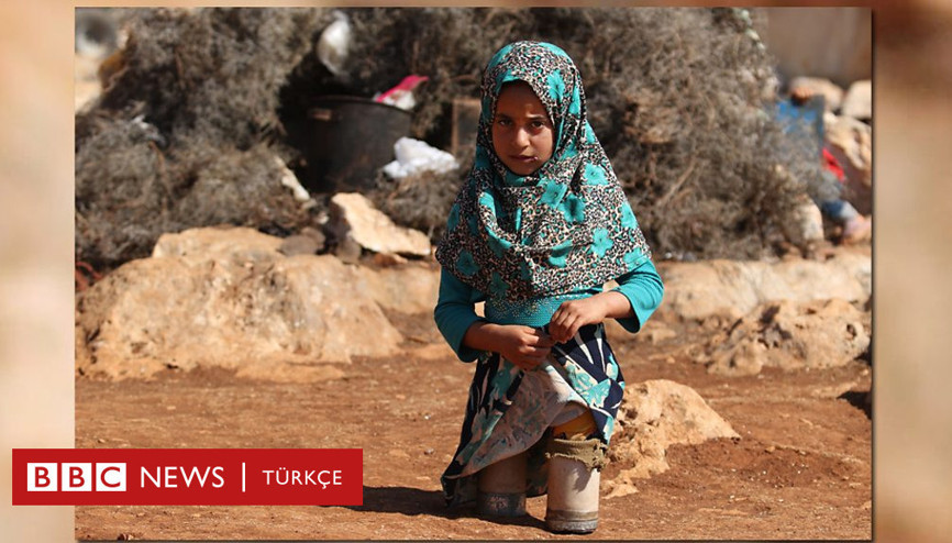 Suriyeli Maya konserve kutuları sonrası gerçek protezlerine kavuştu