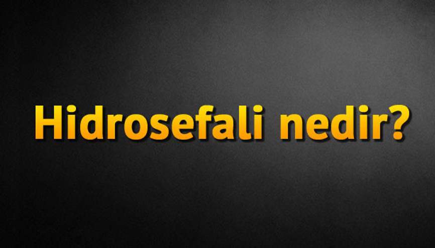 Hidrosefali nedir