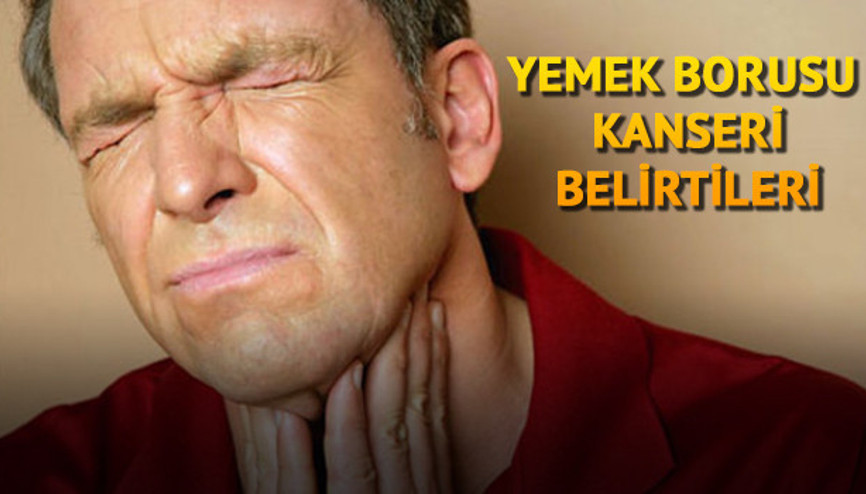 Yemek borusu kanseri belirtileri nelerdir Yemek borusu kanseri nedir