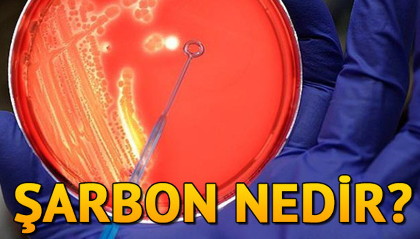 Şarbon nedir Şarbon hastalığının belirtileri Şarbon nedir Şarbon hastalığının belirtileri