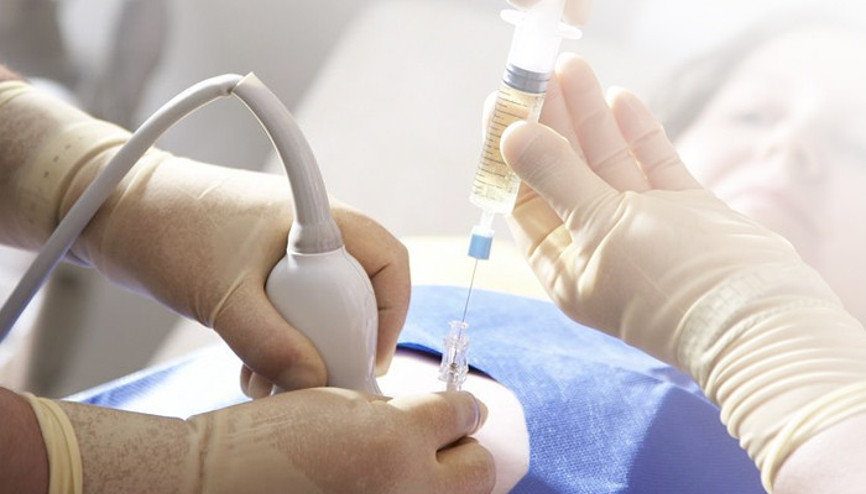 Endometrium (rahim kanseri) nedir Rahim kanseri nasıl anlaşılır