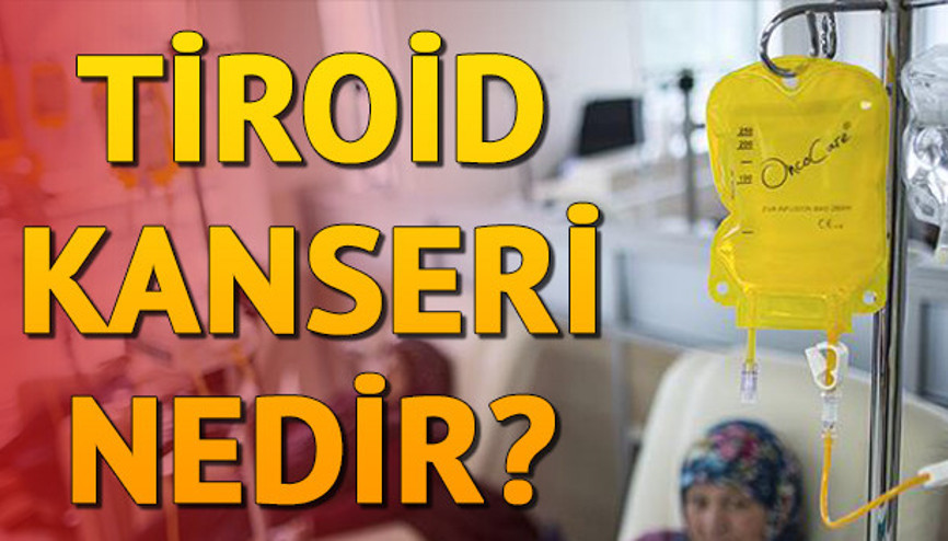 Tiroid kanseri nedir Tiroid kanseri tedavisi
