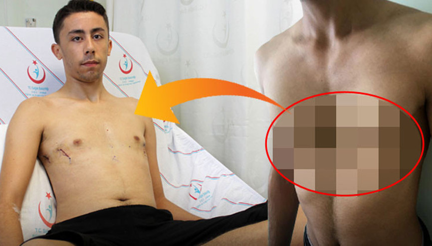 Ameliyattan sonra ilk işi aynaya bakmak oldu Eski hali...