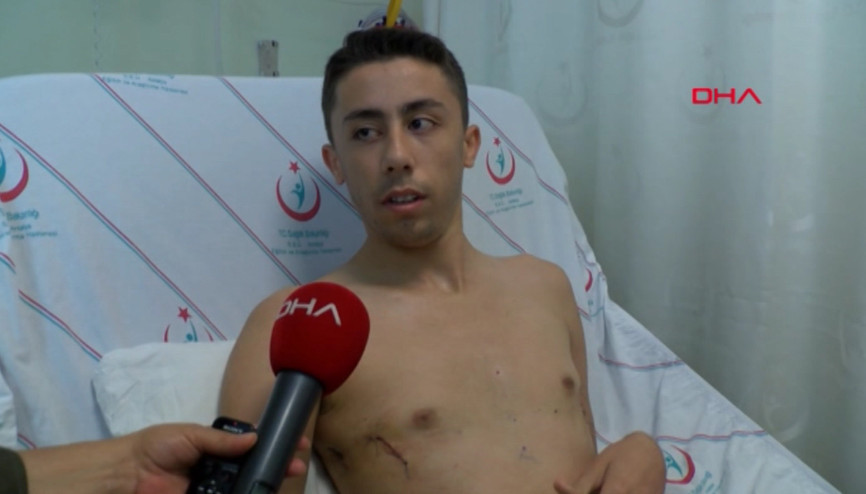 Ameliyattan sonra ilk işi aynaya bakmak oldu