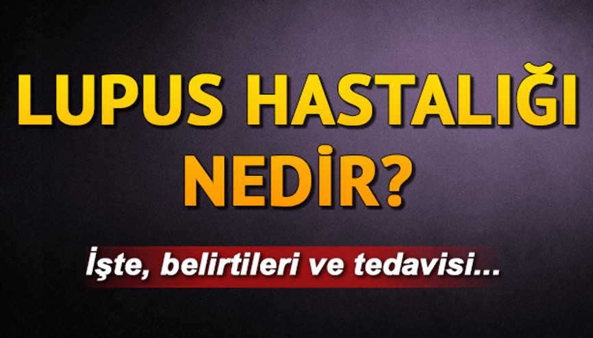 Lupus hastalığı nedir Lupus belirtileri