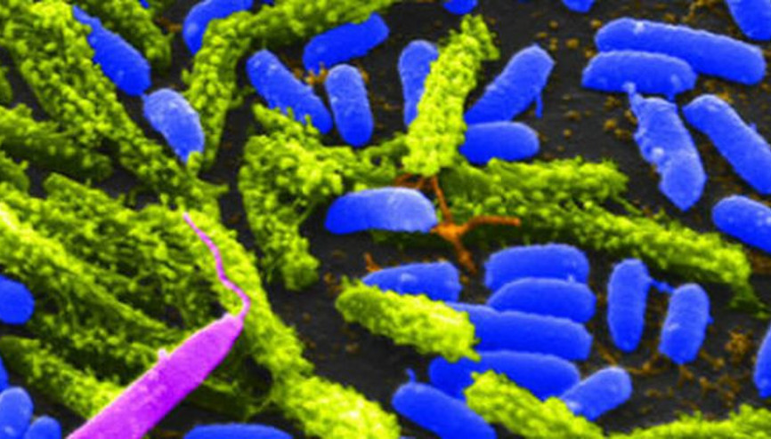 Korkutan uyarı: Salgın yayılabilir