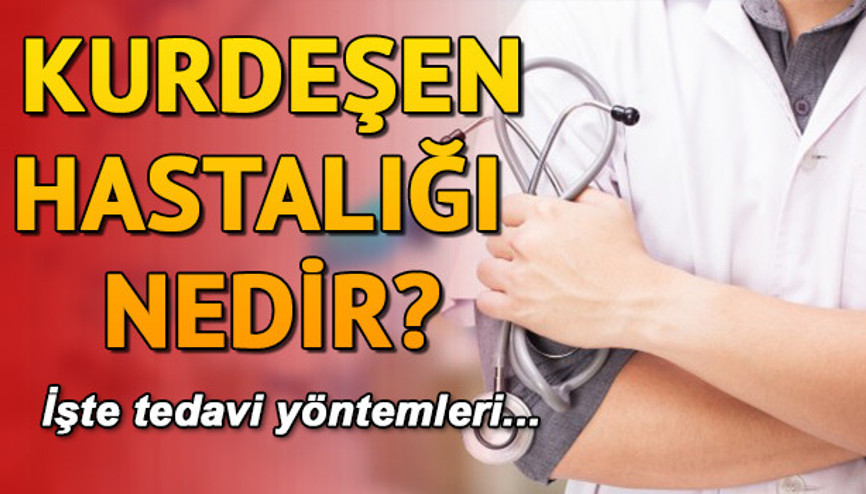Kurdeşen nedir Kurdeşen hastalığı neden olur