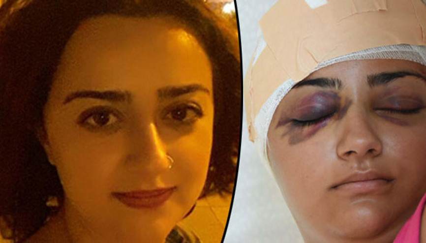 Tuğçe’yi kaldırım taşıyla hastanelik etti. Serbest kaldı