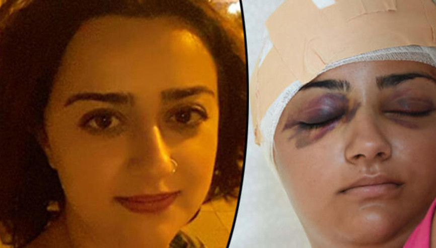 Tuğçeye kaldırım taşıyla saldıran kişi serbest kaldı