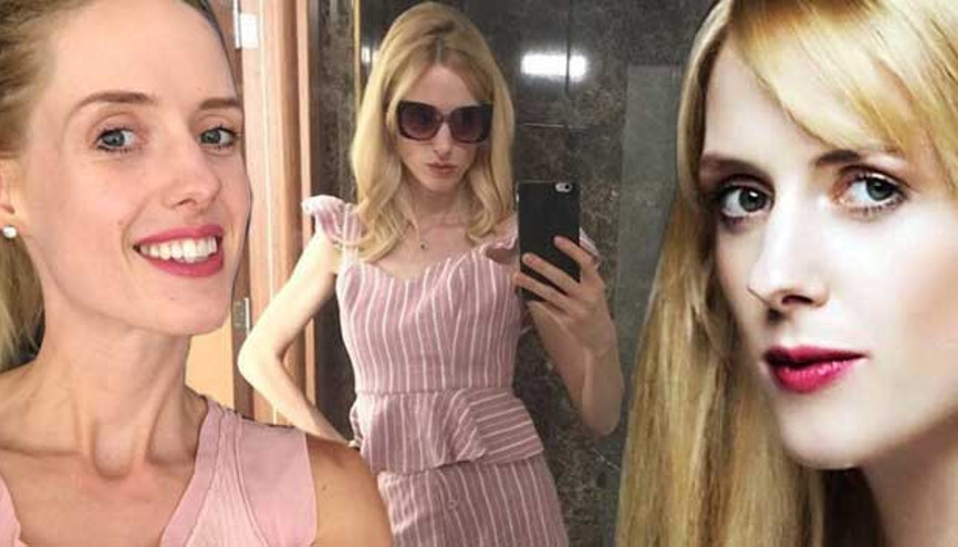 Son görüntüsü korkuttu Wilma anoreksiya mı oldu