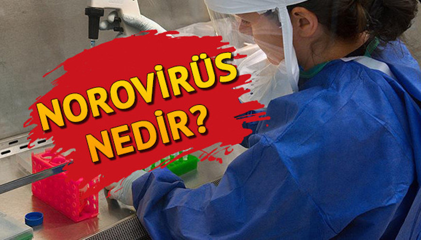 Norovirüs nedir İşte, Norovirüs enfeksiyonu hakkında detaylar Norovirüs nedir İşte, Norovirüs enfeksiyonu hakkında detaylar