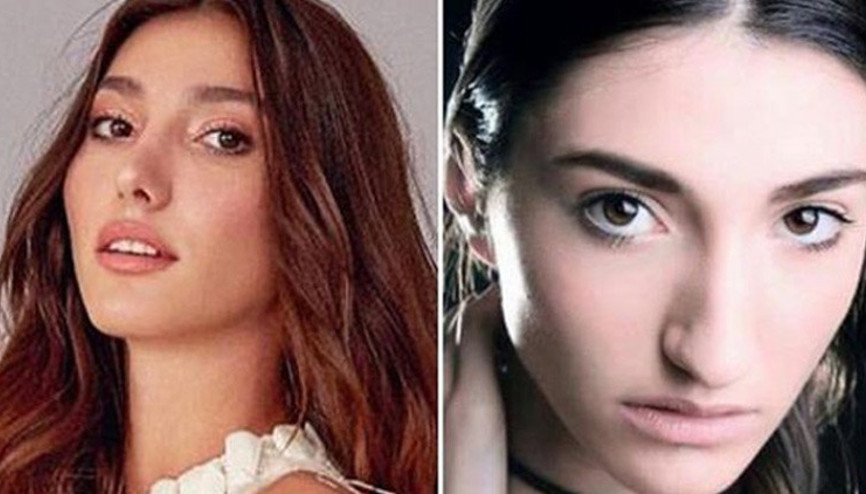 Miss Turkey birincisi Şevval Şahinin estetiksiz hali