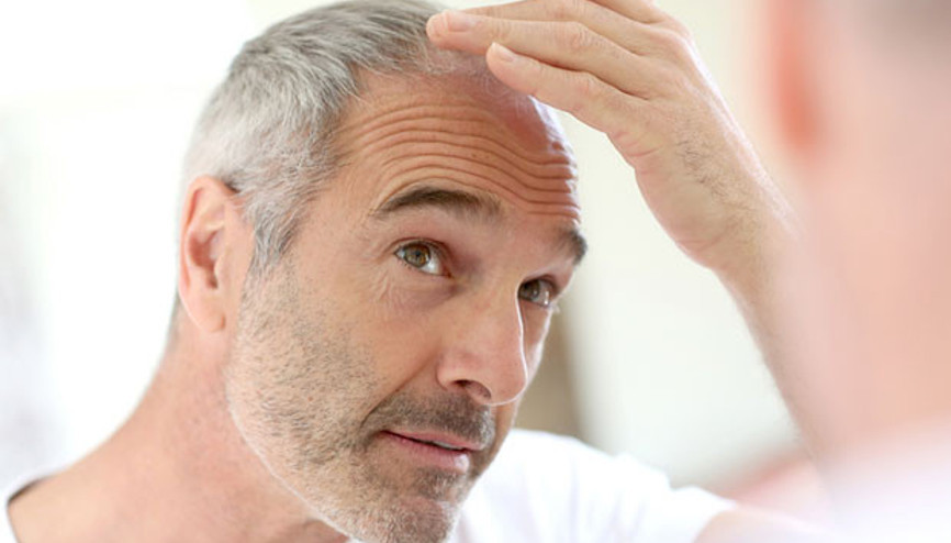 Bir modern tıp mucizesi; Saç ekimi operasyonu