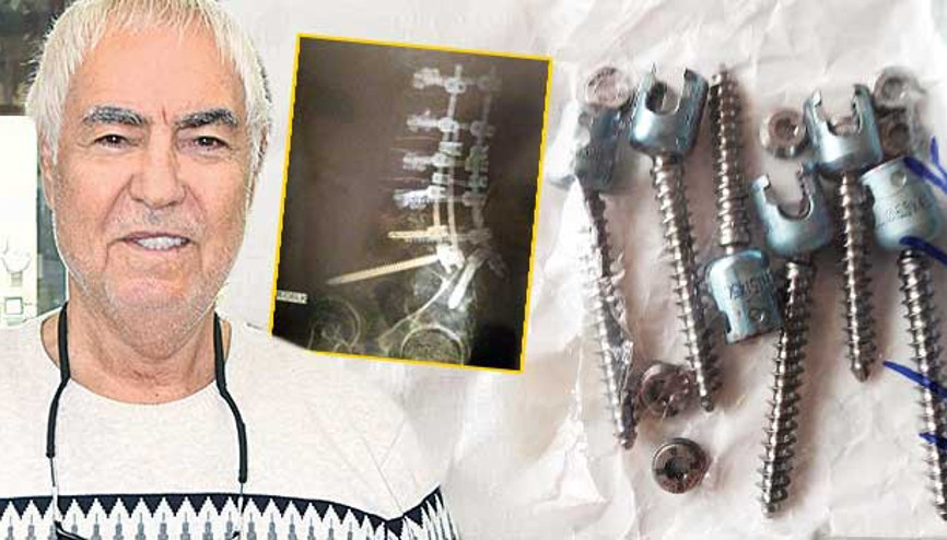 Bu çiviler benden çıktı