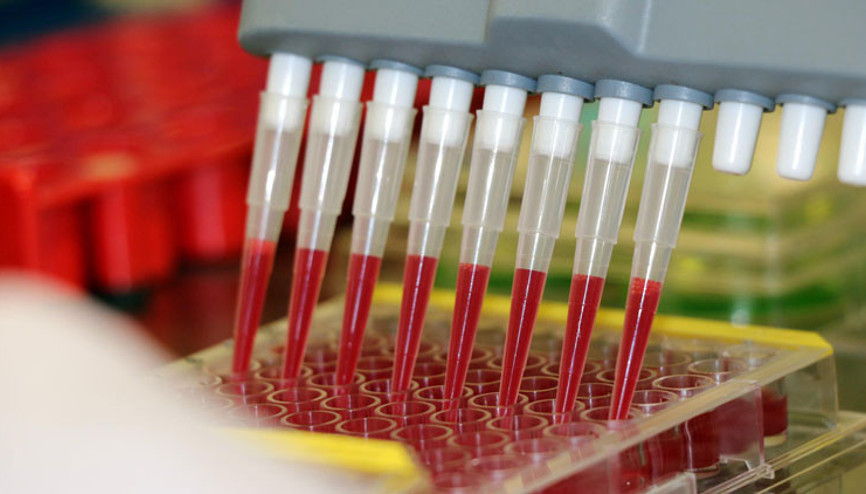 Türkiye’de 10 yıldır araştırılıyordu Ve tespit edildi…