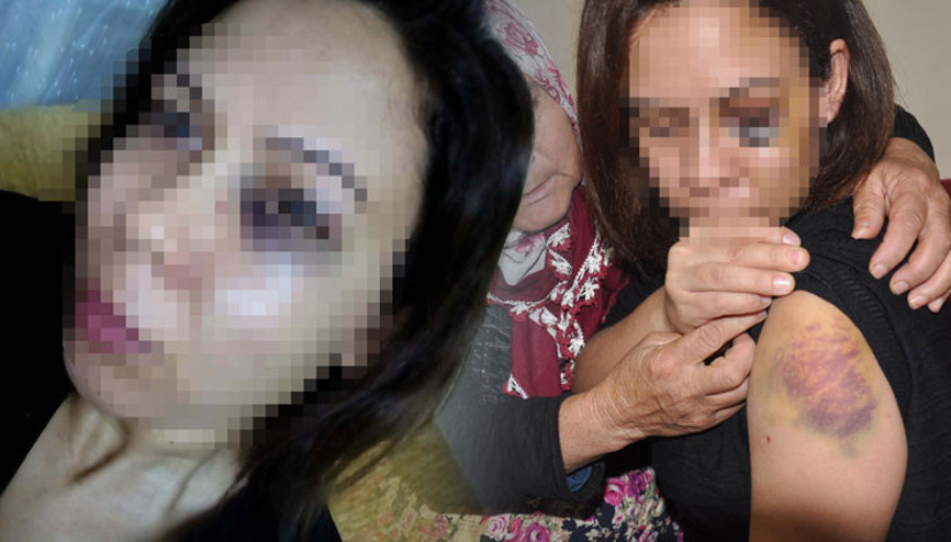 Yaşadıkları korkunç ‘Sürekli ensemde birisi varmış gibi hissediyorum’