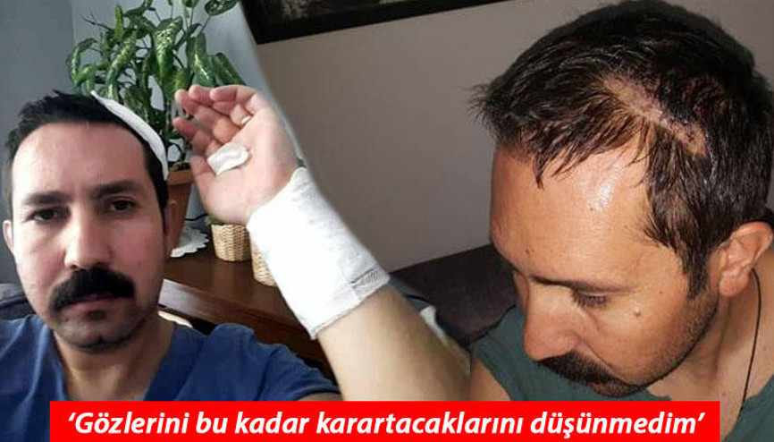 Gıda mühendisine, evinin önünde saldırı