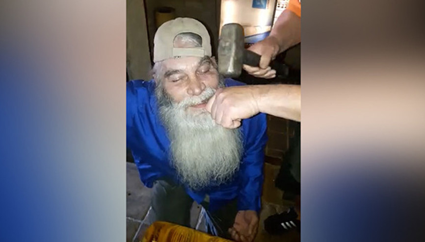 İlkel diş çekme yöntemi