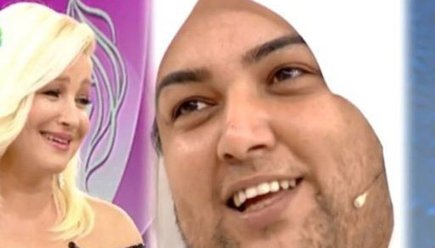 Zahide Yetişteki sakallı kadın iyileşti mi İşte son hali