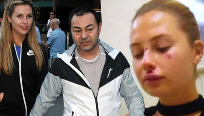 Serdar Ortaçın eşi Chloe ile ilgili şaşırtan iddia: Kaza değil,darp edildi