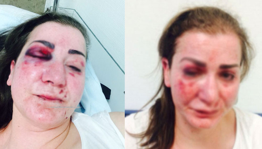 Almanyada Türk kadına saldırı