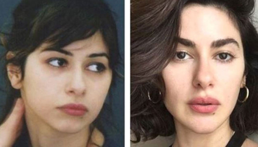 Nesrin Cavadzadeden estetik iddialarına yanıt