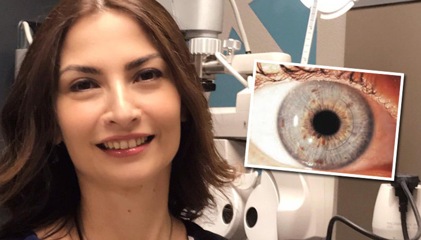 Kornea için göz oyulmuyor Kornea için göz oyulmuyor