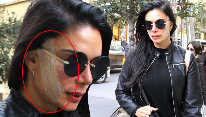 Sevda Demirelin yüzüne ne oldu