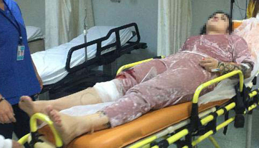 Ablası ile sevgilisini vurup kaçtı