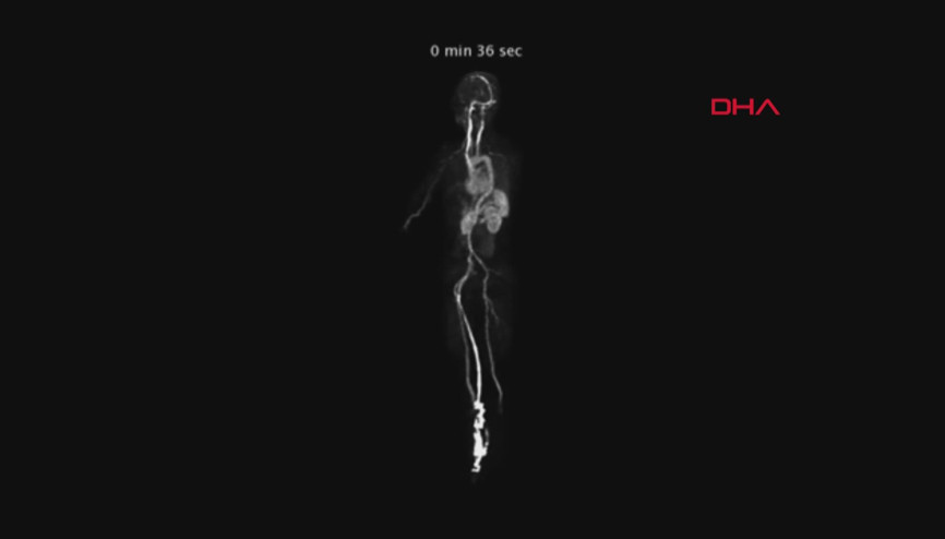 İnsan vücudunu tamamen 3 boyutlu tarayan cihaz