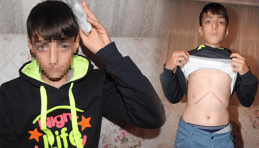 Ortaokulda skandal iddia ‘Zaten ameliyatlıydı…’