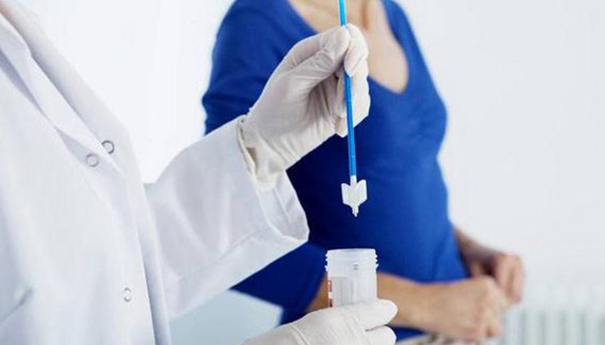 Smear (PAP) testi nedir Smear testi kimlere yapılır