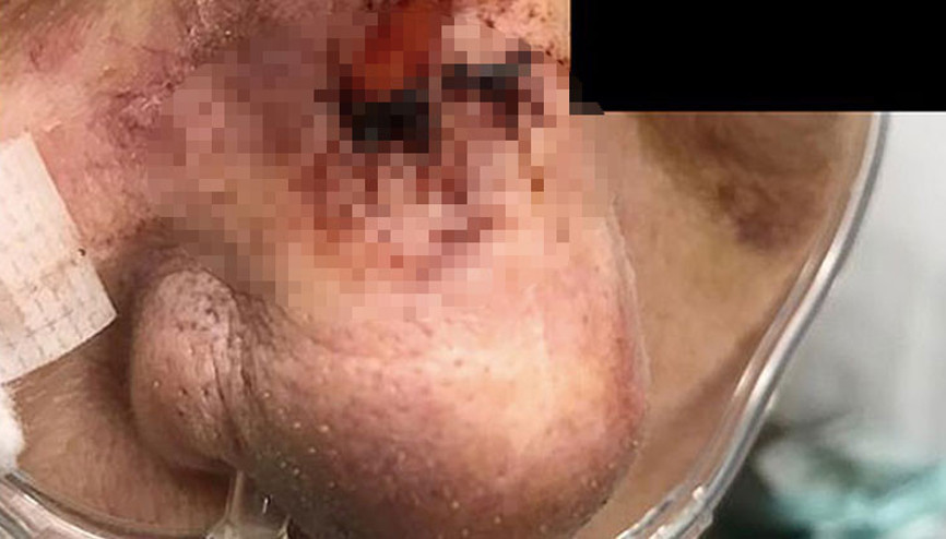 Beyin yiyen amip kaptı, hayatını kaybetti