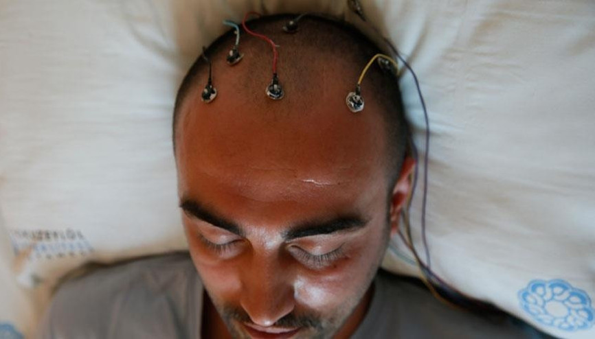 Epilepsi nedir Epilepsi hastalığı nasıl anlaşılır Epilepsi nedir Epilepsi hastalığı nasıl anlaşılır