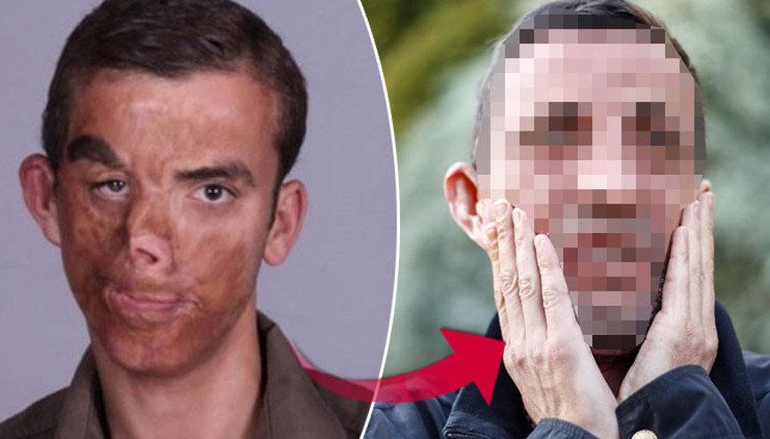 Aradan tam 7 yıl geçti İşte Uğur Acar’ın son hali… Aradan tam 7 yıl geçti İşte Uğur Acar’ın son hali…