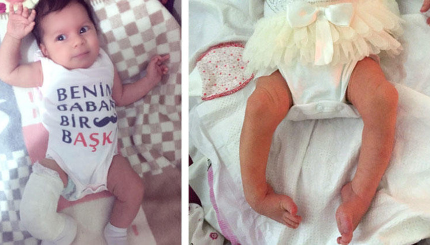 ‘Doktorun ihmali bebeği ayağından ediyordu’ iddiası