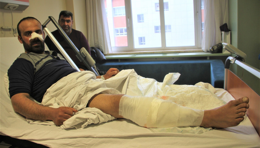 Burnunu ve bacağını parçaladılar Yumrukla vurdum ama bırakmadılar