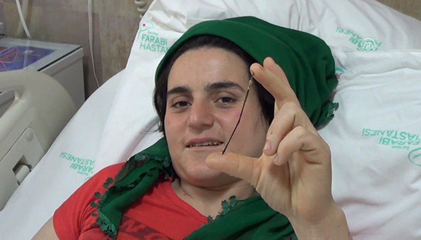 Karnındaki iğneyle 26 yıl yaşadı