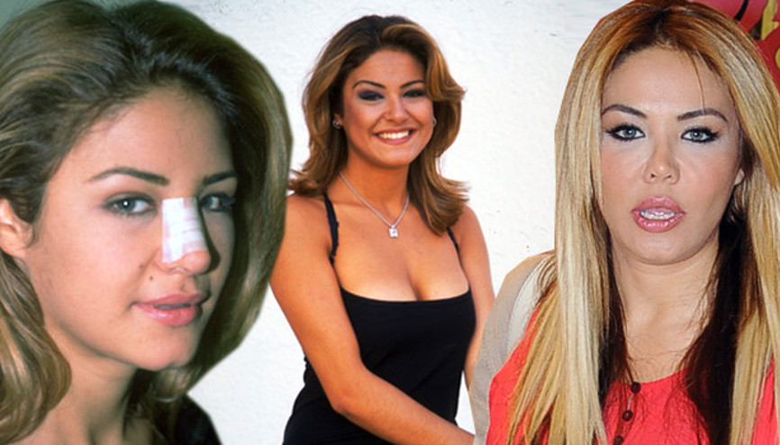 Esra Balamirin büyük pişmanlığı Keşke estetik yaptırmasaydım...