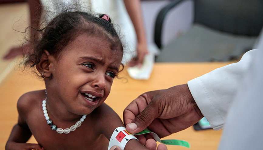 Yemende 3 yaşındaki kız çocukları para ve yemek karşılığında evlendiriliyor