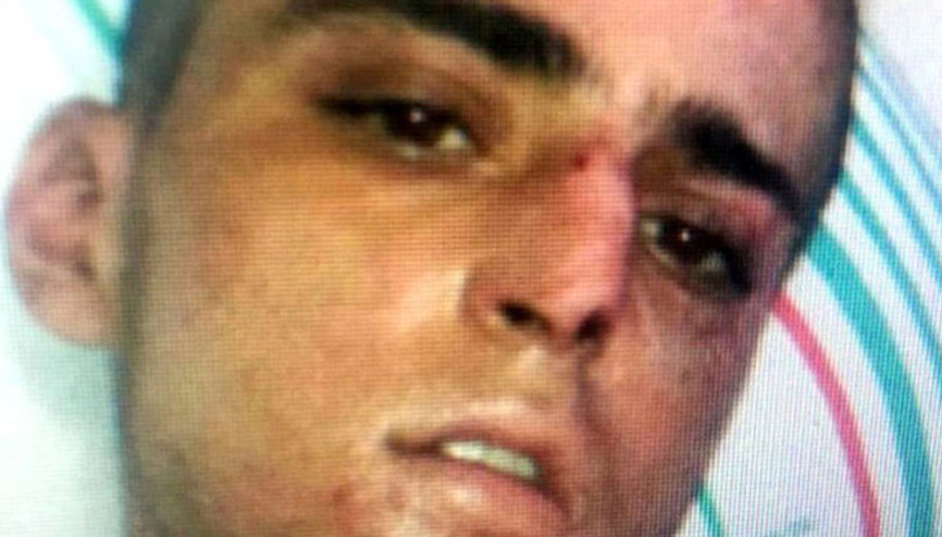 Narkozun etkisi geçerken kendini ele verdi