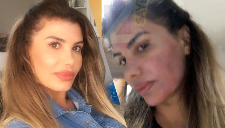 Haticenin yüzüne ne oldu