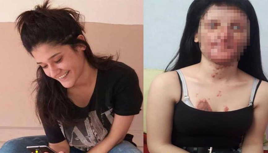 Nişanlısının yüzünü tanınmaz hale getirdiği Berfin için kampanya Nişanlısının yüzünü tanınmaz hale getirdiği Berfin için kampanya