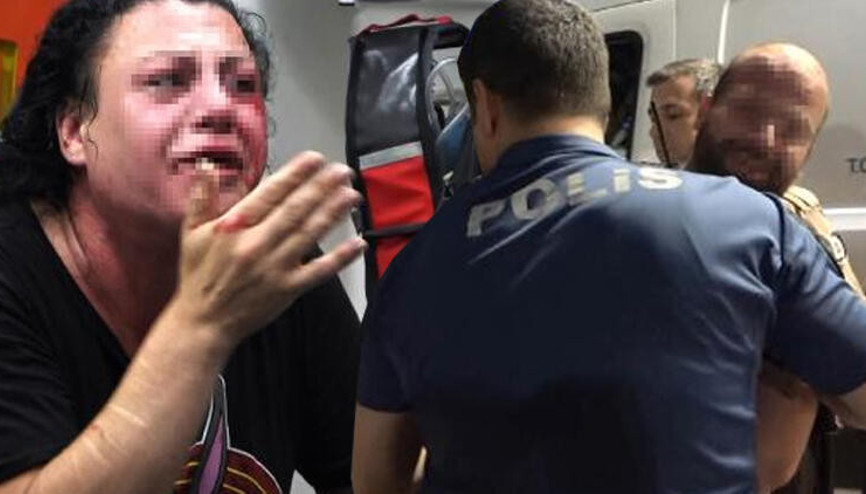 Ortalık karıştı Transseksüel olduğunu öğrenince bu hale getirdi Ortalık karıştı Transseksüel olduğunu öğrenince bu hale getirdi