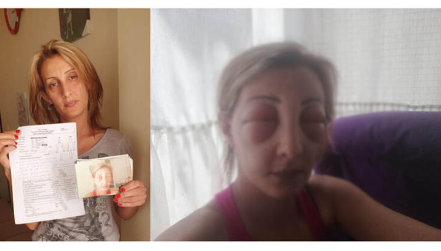 Saçlarını yaptırmak için kuaföre gitti, canından oluyordu